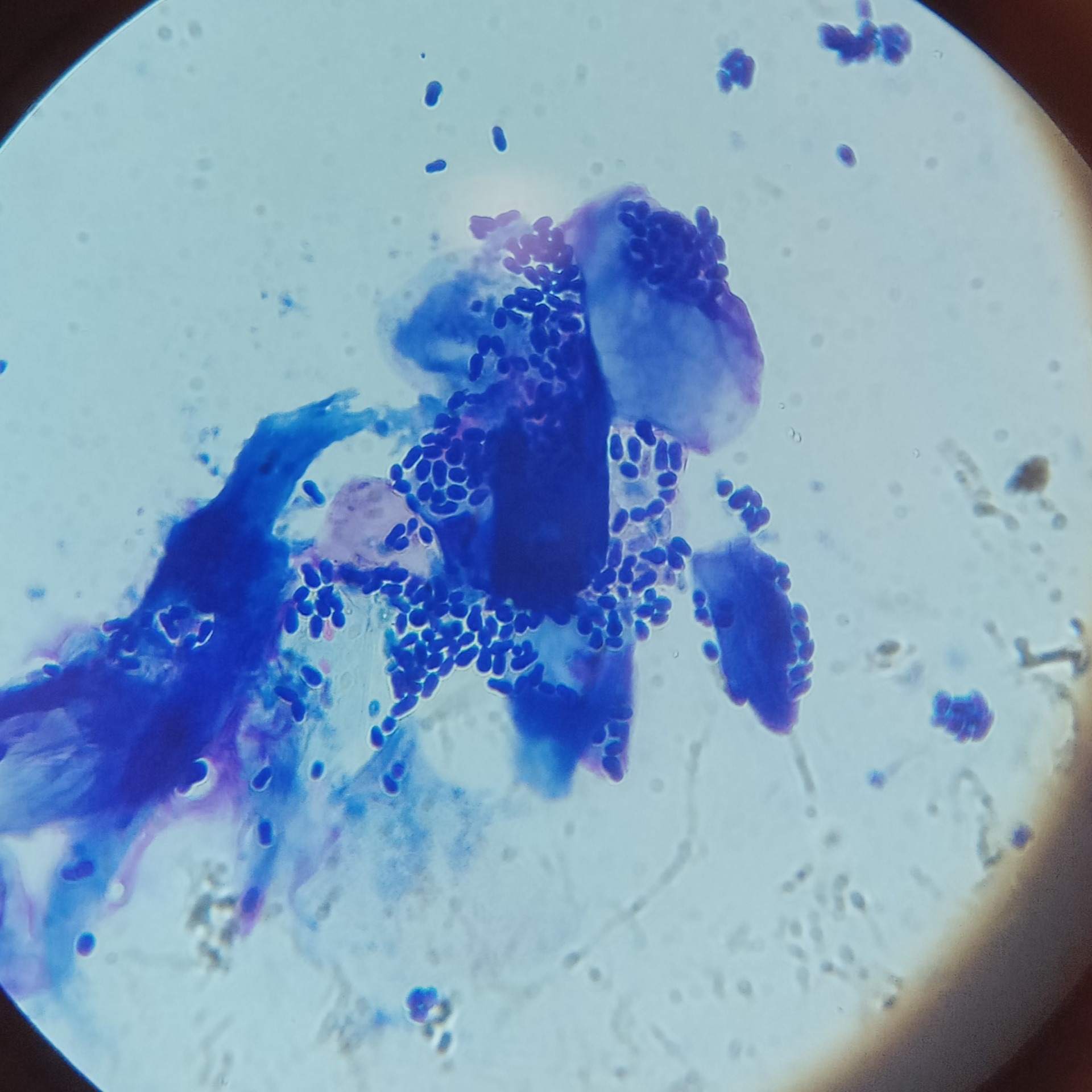 Élesztőgombás fertőzés kutya gyulladt füléből vett mintában