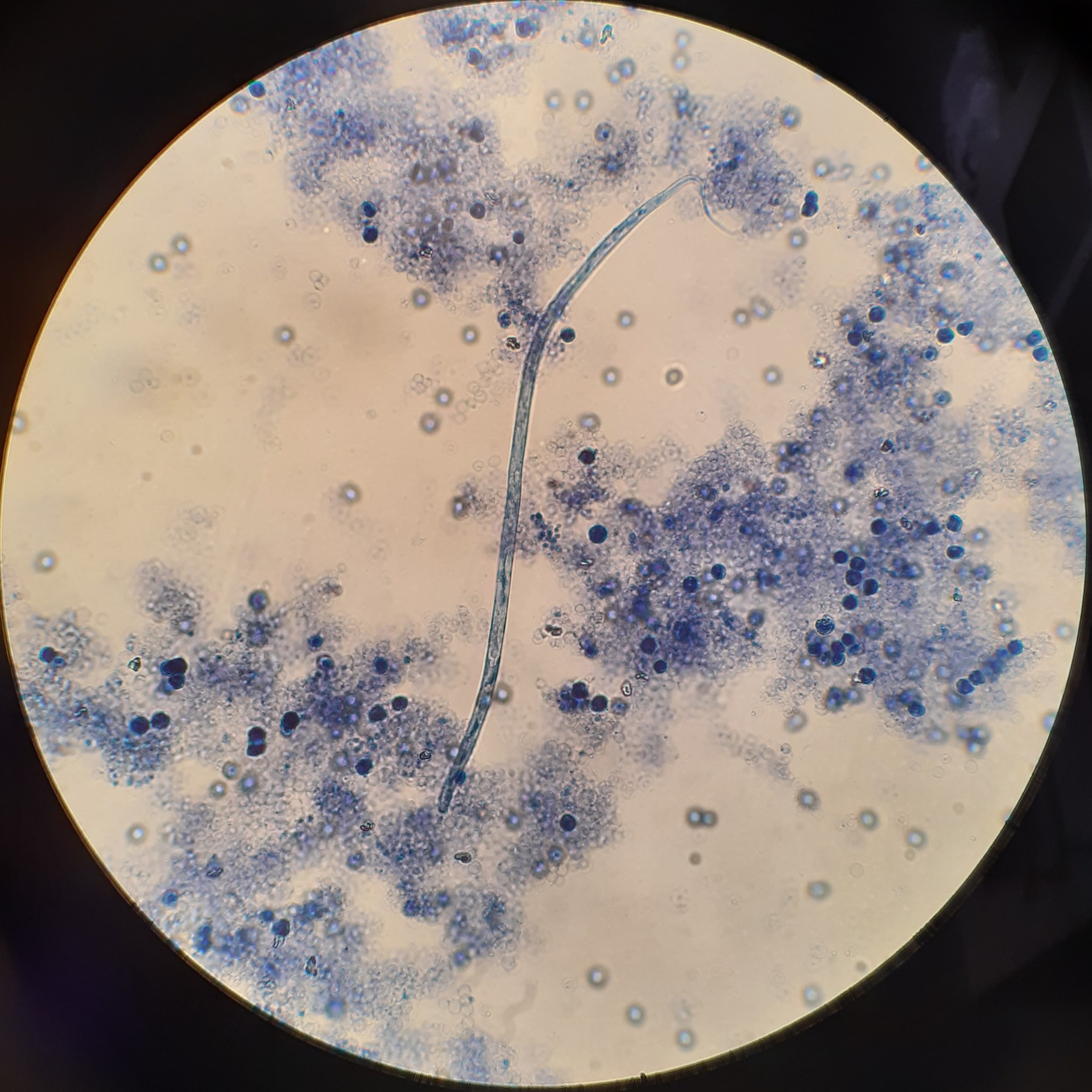 Bőrféreg lárva Knott tesztben